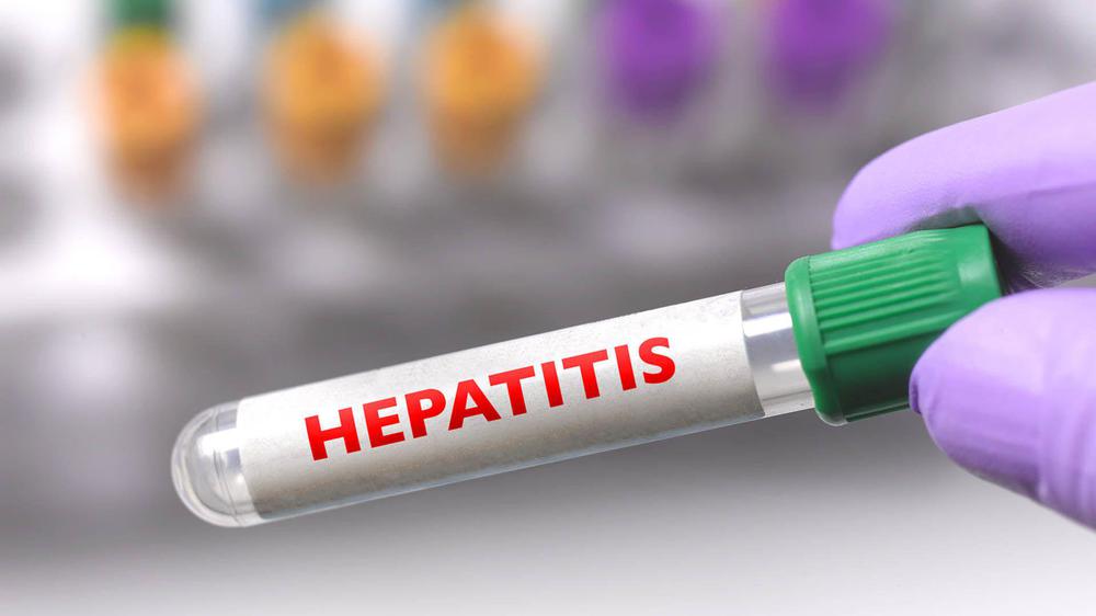 hepatitis1