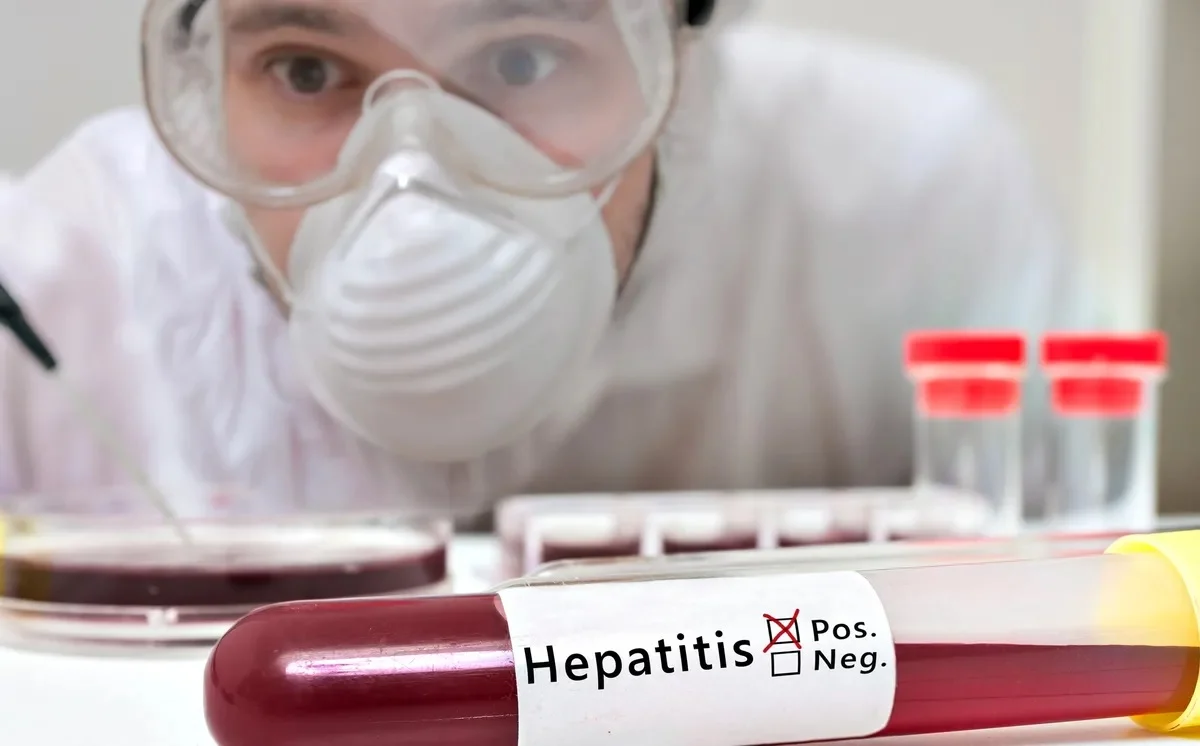 hepatitis10
