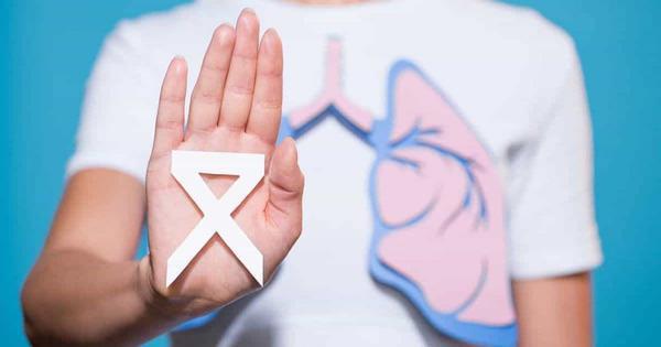 multimedia.miniatura.82bbd9e246af5069.66313336333936373461343034623233616634646161653663633263396433365f6d696e6961747572612e6a706567