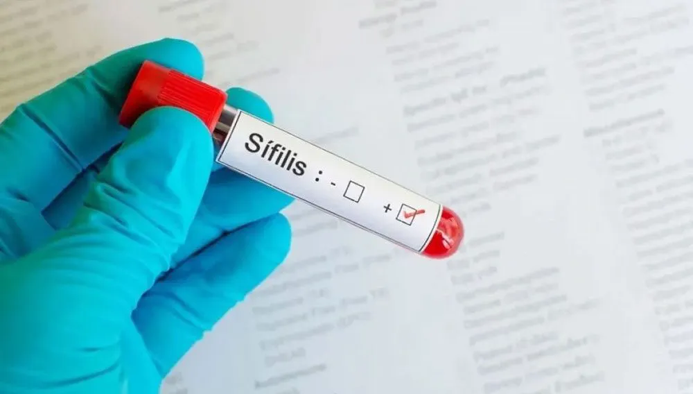 sifilis