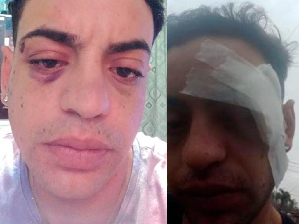 agredieron a joven en boliche de San Lorenzo