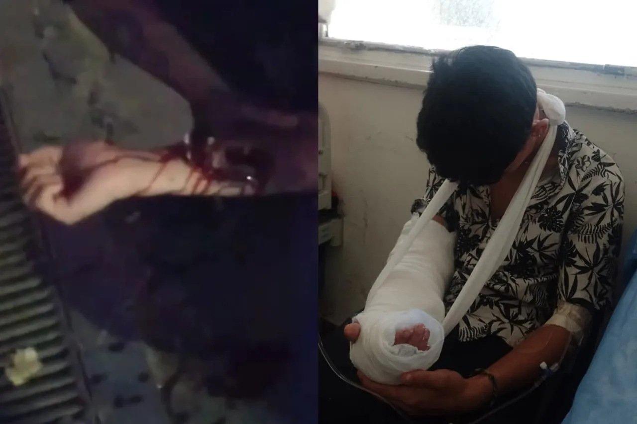 Benjamín herdido de bala