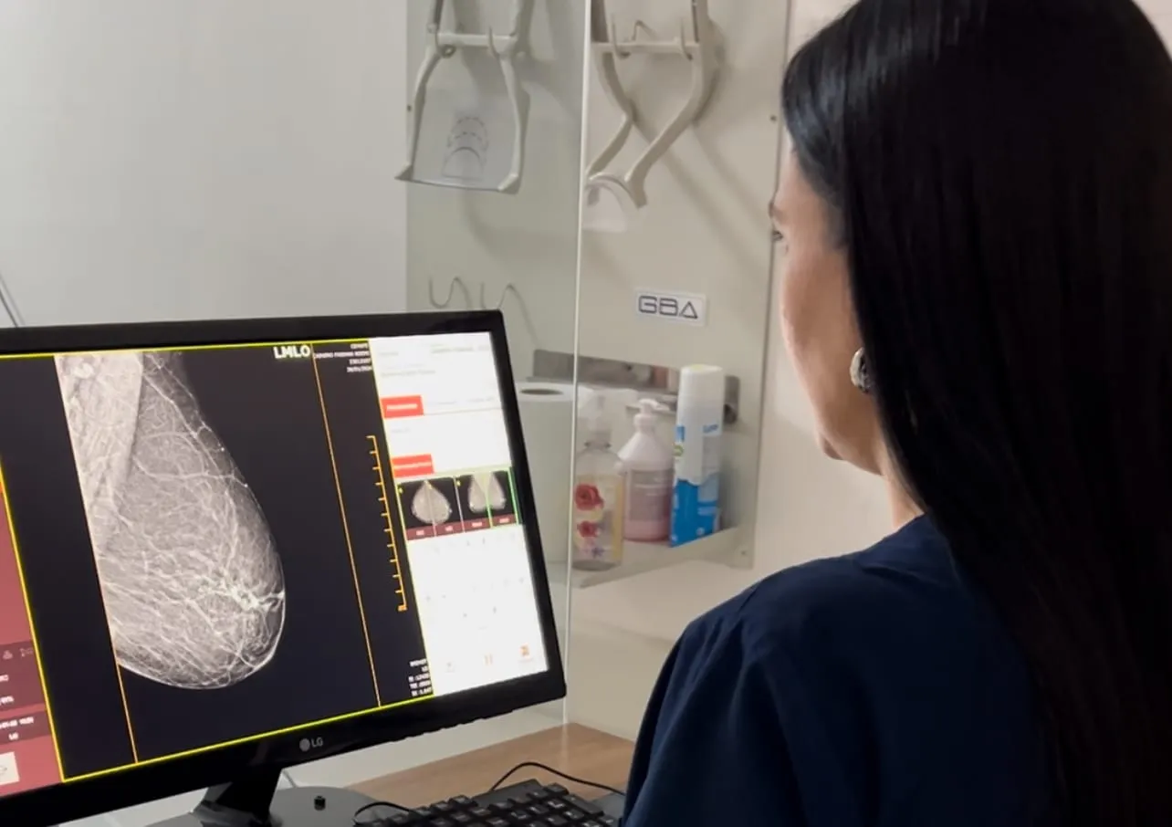 control cancer de mama